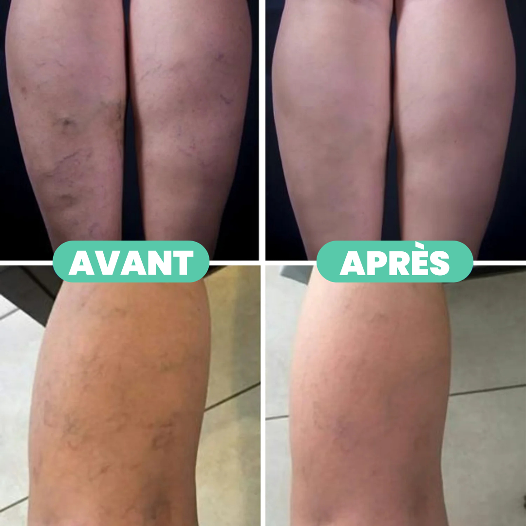 Chaussettes de compression bien-être