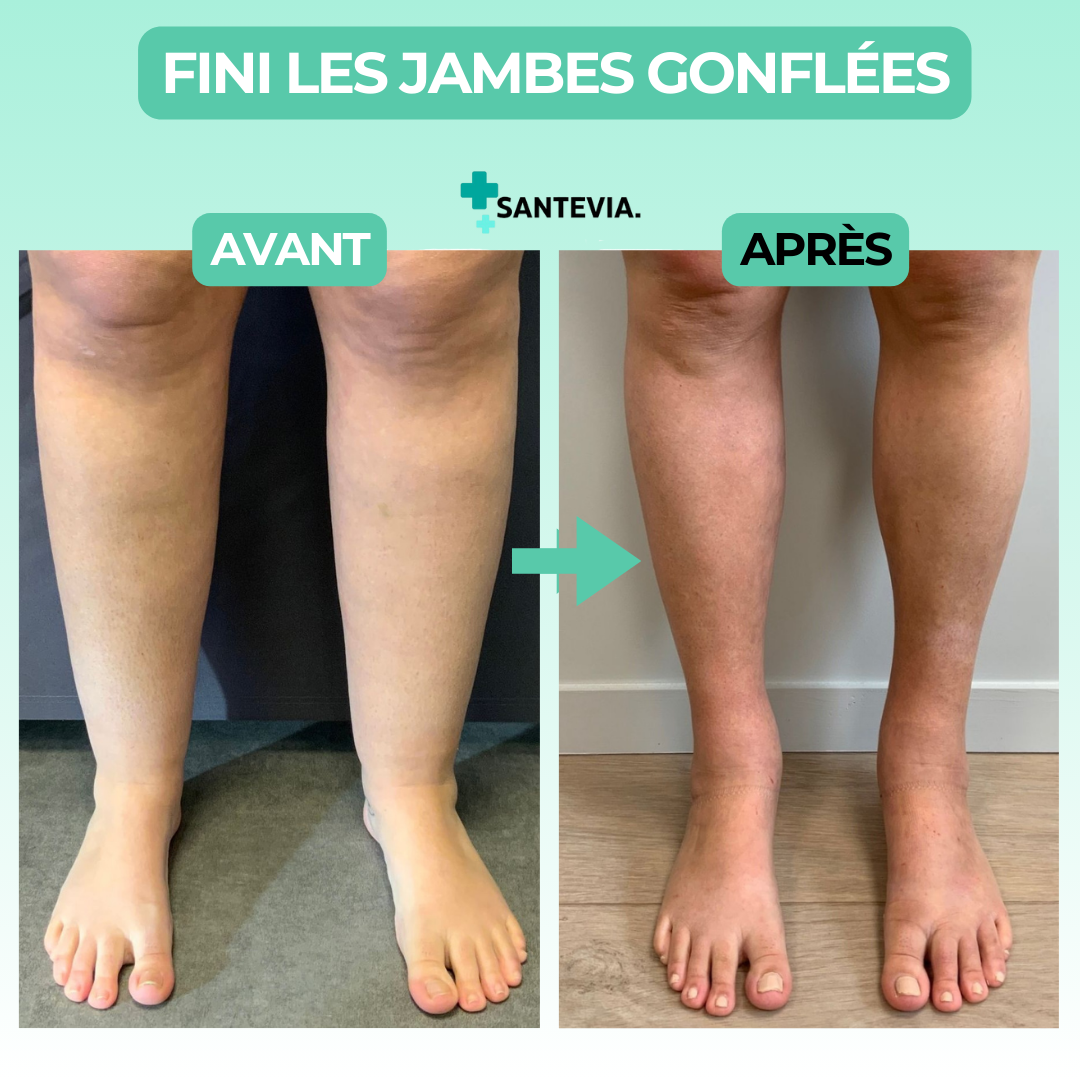 Chaussettes de compression pieds ouverts
