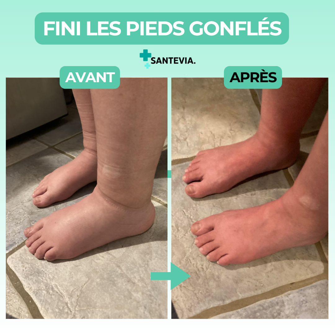 Chaussettes de compression pieds ouverts