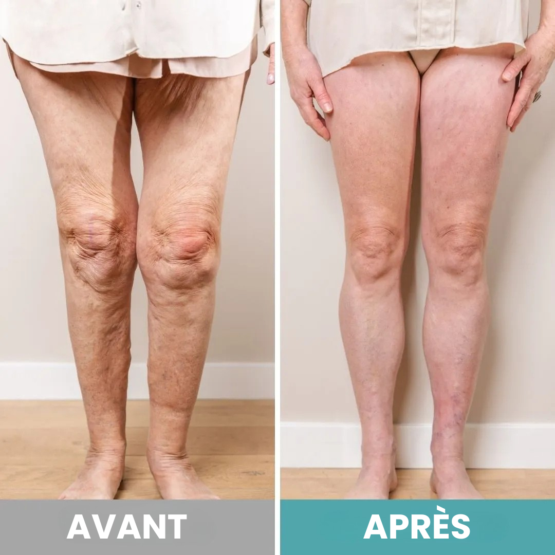 Masseur de pieds SANTEVIA