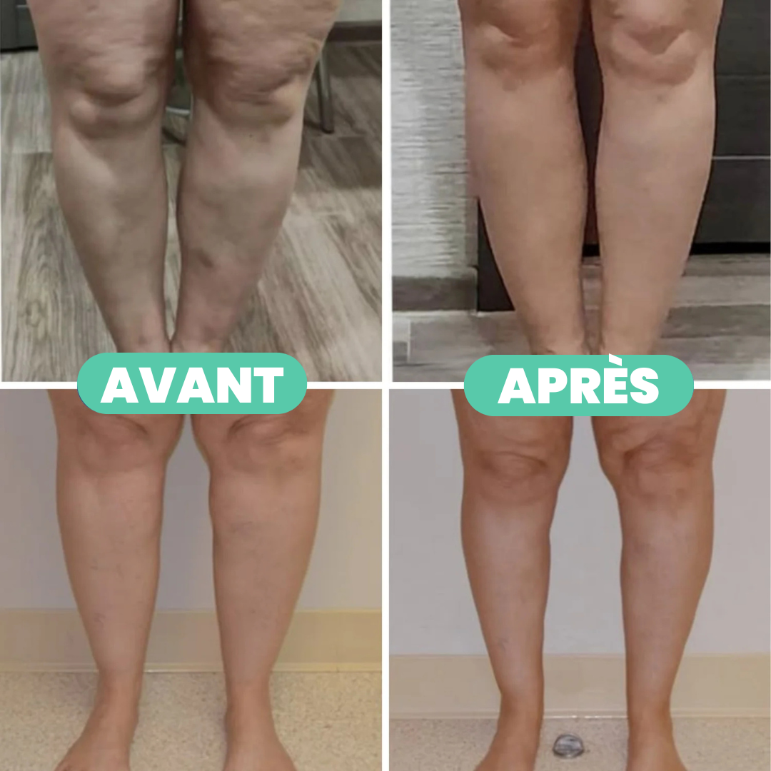 Chaussettes de compression bien-être